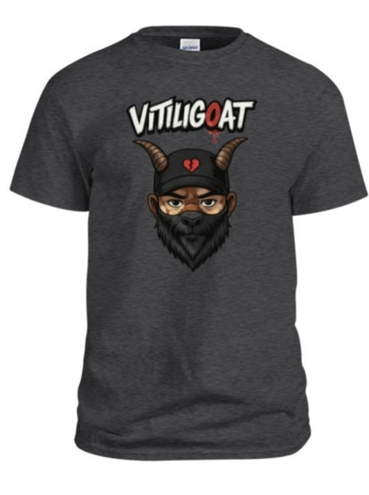 VITILIG⭕️AT